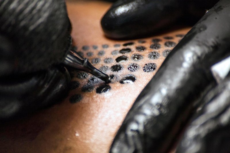 REJUVI TATTOO REMOVER